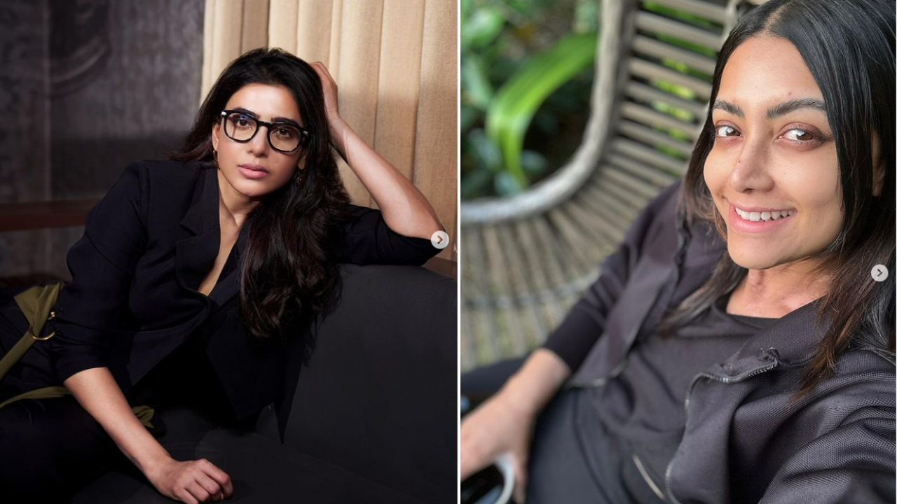 After Samantha, another actress has been diagnosed with an Autoimmune disease