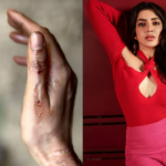 Is Samantha injured on the sets of CITADEL?