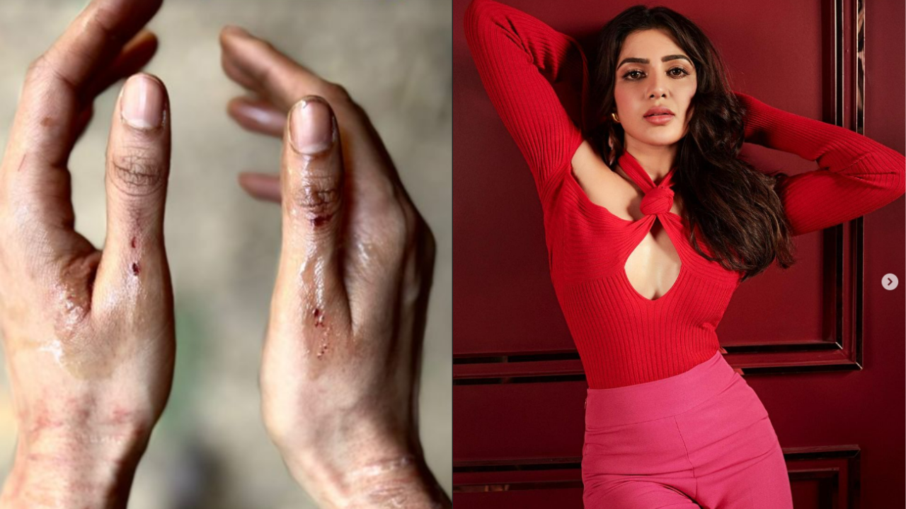 Is Samantha injured on the sets of CITADEL?