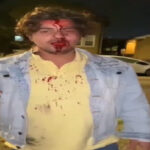 Telangana CM ‘very disconcerted’ over attack on Hyderabad student in US