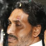 YS Jagan Reddy injured in stone pelting