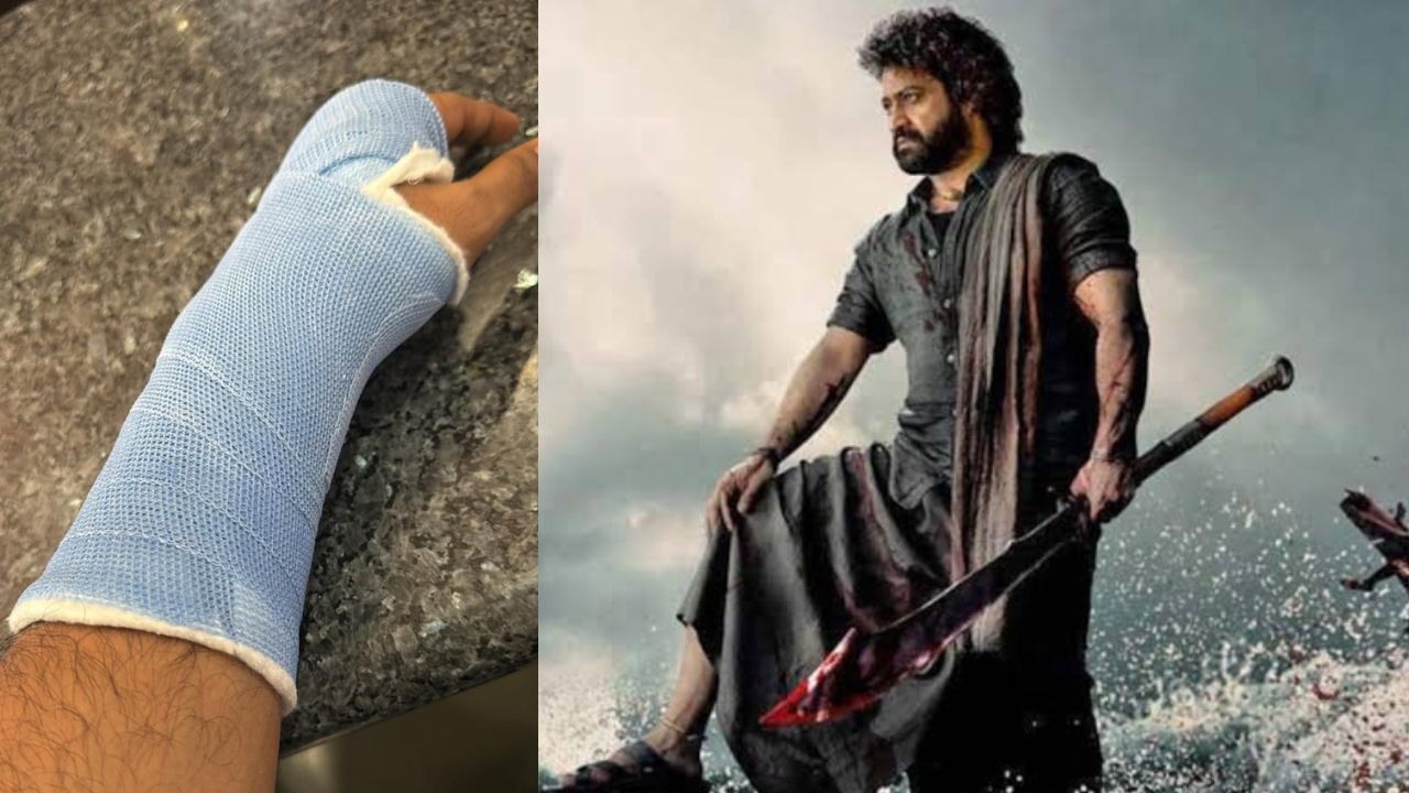 తారక్‌ అభిమానులకు షాక్‌..షూటింగ్‌ లో చేతికి గాయం!