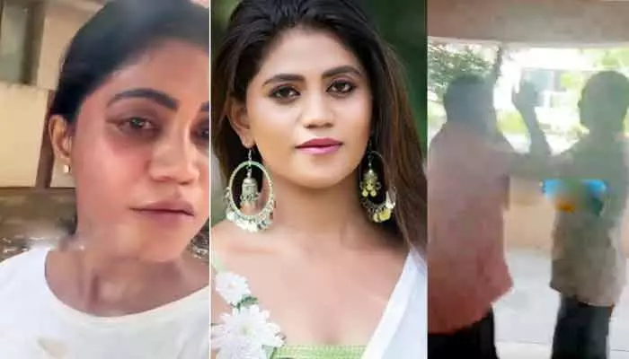 Shocking Attack on Anchor In Rajamundry