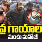 Manchu Manoj Admitted in Hospital